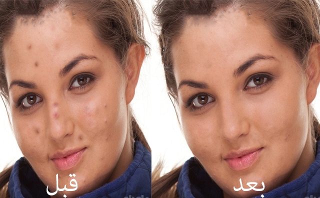 برای سایت فروشگاهی شما دوربری و ادیت عکس انجام بدم