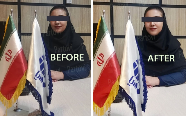 با 14 سال سابقه فعالیت در آتلیه،عکساتونو براتون زیباترکنم (صورت و بدن)