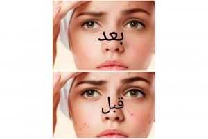 عکس پروفایل بسازم و عکس هایتان را ویرایش کنم